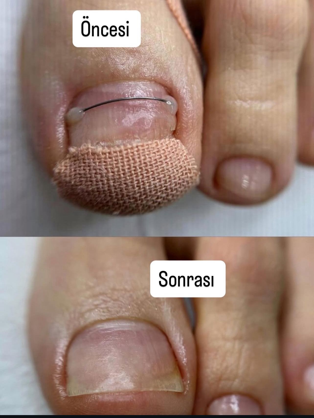 Podolog Nurcan Sarıhan Özel Ayak Sağlığı Merkezi